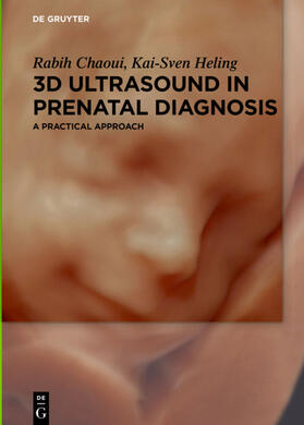 Chaoui / Heling |  3D Ultrasound in Prenatal Diagnosis | Buch |  Sack Fachmedien
