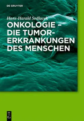 Sedlacek |  Onkologie - die Tumorerkrankungen des Menschen | Buch |  Sack Fachmedien