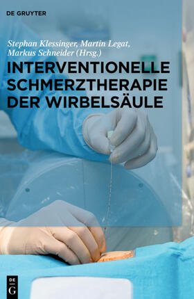 Klessinger / Legat / Schneider | Interventionelle Schmerztherapie der Wirbelsäule | Buch | sack.de