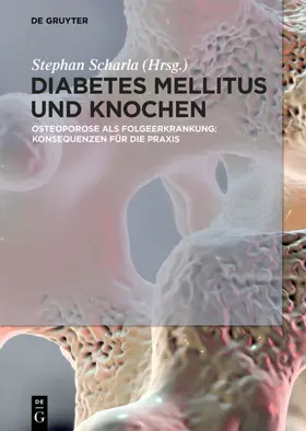 Scharla | Diabetes Mellitus und Knochen | E-Book | sack.de