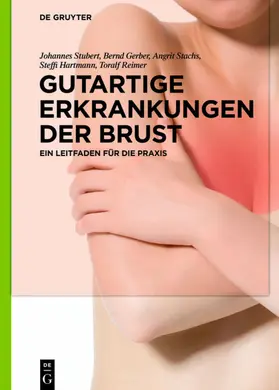 Stubert / Gerber / Stachs |  Gutartige Erkrankungen der Brust | eBook | Sack Fachmedien