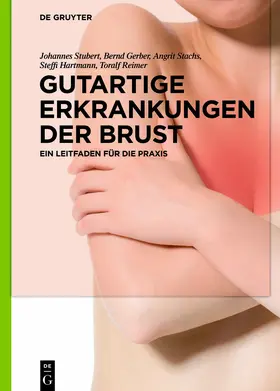 Stubert / Gerber / Stachs |  Gutartige Erkrankungen der Brust | eBook | Sack Fachmedien