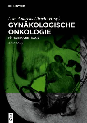 Ulrich | Gynäkologische Onkologie | E-Book | www.sack.de
