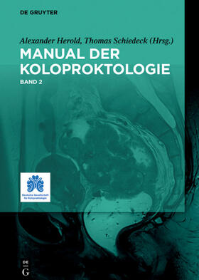 Herold / Schiedeck | Manual der Koloproktologie, 2 | Buch | sack.de