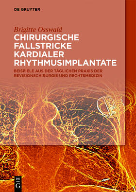 Osswald | Osswald, B: Chirurgische Fallstricke kardialer Rhythmusimpla | Buch | 978-3-11-063696-3 | sack.de
