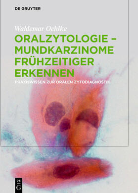 Oehlke |  Oralzytologie - Mundkarzinome frühzeitiger erkennen | eBook | Sack Fachmedien