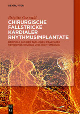 Osswald | Chirurgische Fallstricke kardialer Rhythmusimplantate | E-Book | sack.de