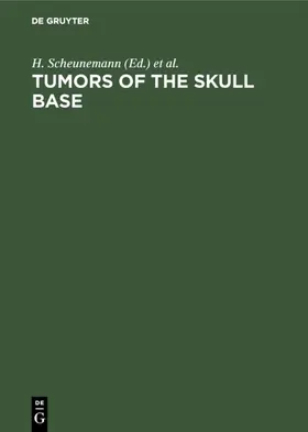 Scheunemann / Schürmann / Helms |  Tumors of the skull base | eBook | Sack Fachmedien