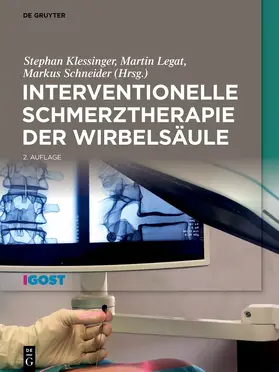Klessinger / Legat / Schneider |  Interventionelle Schmerztherapie der Wirbelsäule | eBook | Sack Fachmedien