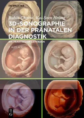 Chaoui / Heling | 3D-Sonographie in der pränatalen Diagnostik | Buch | sack.de
