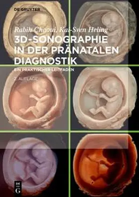 Chaoui / Heling | 3D-Sonographie in der pränatalen Diagnostik | E-Book | sack.de
