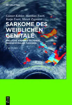  Sarkome des weiblichen Genitale / Glattmuskuläre und stromale Tumoren | Buch |  Sack Fachmedien