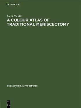 Smillie |  A Colour Atlas of Traditional Meniscectomy | eBook | Sack Fachmedien