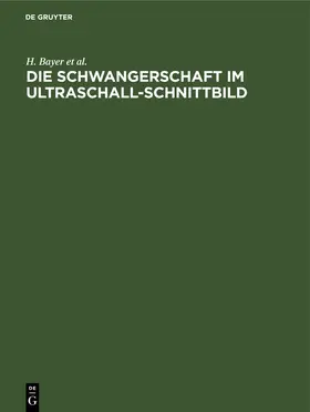 Bayer / Schulte / Prenzlau |  Die Schwangerschaft im Ultraschall-Schnittbild | eBook | Sack Fachmedien