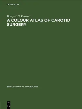 Eastcott |  A Colour Atlas of Carotid Surgery | Buch |  Sack Fachmedien