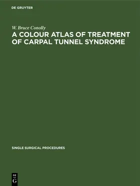 Conolly |  A Colour Atlas of Treatment of Carpal Tunnel Syndrome | Buch |  Sack Fachmedien