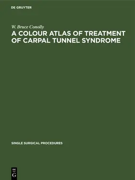 Conolly |  A Colour Atlas of Treatment of Carpal Tunnel Syndrome | eBook | Sack Fachmedien
