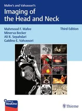 Mafee / Becker / Sepahdari |  Mafee's and Valvassori's Imaging of the Head and Neck | Buch |  Sack Fachmedien