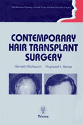 Kenneth A. Buchwach | Contemporary Hair Transplant Surgery | Buch | 978-3-13-103781-7 | sack.de