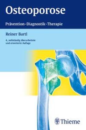 Bartl | Osteoporose | Buch | 978-3-13-105754-9 | sack.de