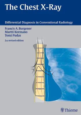 Burgener / Kormano / Pudas |  The Chest X-Ray | Buch |  Sack Fachmedien
