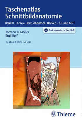 Möller / Reif | Taschenatlas Schnittbildanatomie 02 | Medienkombination | sack.de