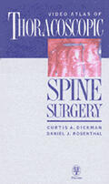 Dickman / Rosenthal |  Video Atlas of Thoracoscopic Spine Surgery, VHS/NTSC | Buch |  Sack Fachmedien