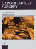 Christopher M. Loftus |  Carotid Artery Surgery | Buch |  Sack Fachmedien