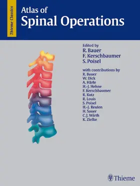 Bauer / Kerschbaumer / Poisel |  Atlas of Spinal Operations | Buch |  Sack Fachmedien