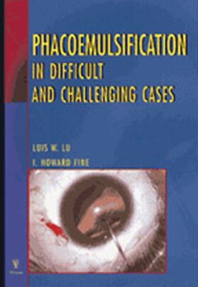 Luis W. Lu | Phacoemulsification in Difficult and Challenging Cases | Buch | 978-3-13-114671-7 | sack.de
