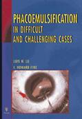 Luis W. Lu |  Phacoemulsification in Difficult and Challenging Cases | Buch |  Sack Fachmedien