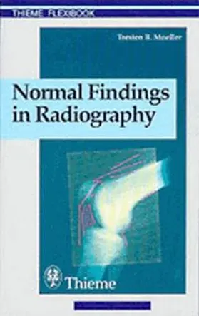 Moeller | Normal Findings in Radiography | Buch | 978-3-13-116531-2 | www.sack.de