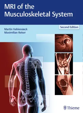 Vahlensieck / Reiser | MRI of the Musculoskeletal System | Buch | 978-3-13-116572-5 | sack.de