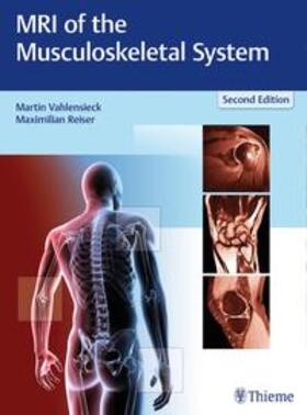 Vahlensieck / Reiser | MRI of the Musculoskeletal System | Buch | 978-3-13-116572-5 | sack.de
