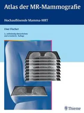 Fischer |  Atlas der MR-Mammografie | Buch |  Sack Fachmedien