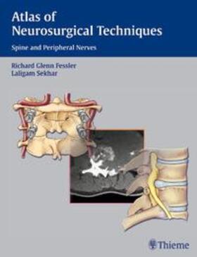 Fessler / Sekhar | Atlas of Neurosurgical Techniques | Buch | 978-3-13-127531-8 | sack.de