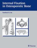 Yuehuei H. An |  Internal Fixation in Osteoporatic Bone | Buch |  Sack Fachmedien