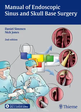 Simmen / Jones | Manual of Endoscopic Sinus and Skull Base Surgery | Buch | 978-3-13-130972-3 | sack.de