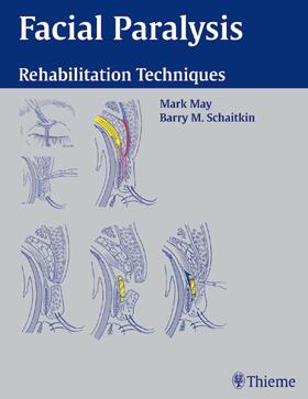 M. May | Facial Paralysis | Buch | 978-3-13-132241-8 | sack.de