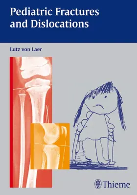 von Laer |  Pediatric Fractures and Dislocations | Buch |  Sack Fachmedien