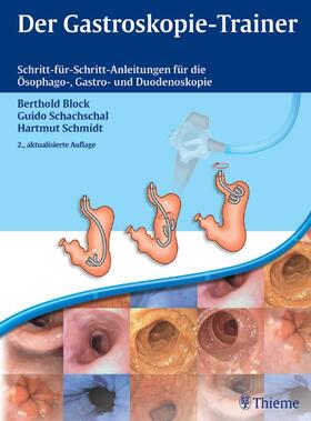 Block / Schachschal / Schmidt |  Der Gastroskopie-Trainer | Buch |  Sack Fachmedien