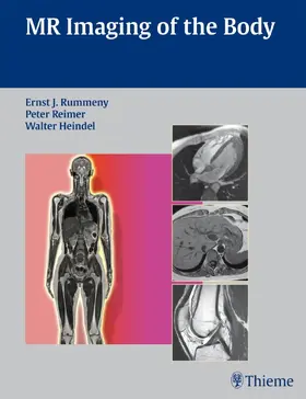 Rummeny / Reimer / Heindel |  MR Imaging of the Body | Buch |  Sack Fachmedien