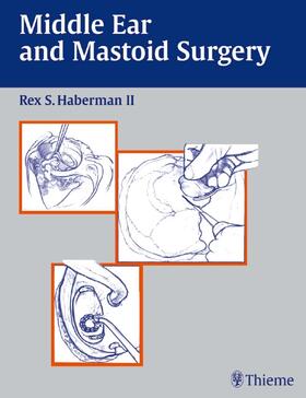 Rex S. Haberman |  Middle Ear and Mastoid Surgery | Buch |  Sack Fachmedien