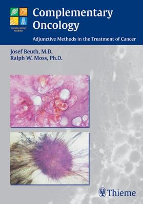 Beuth / Moss | Complementary Oncology | Buch | 978-3-13-137451-6 | sack.de