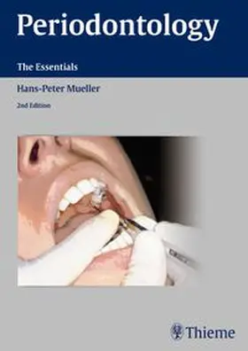 Müller | Periodontology | Buch | 978-3-13-138372-3 | www.sack.de