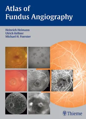 Heimann / Foerster / Kellner | Atlas of Fundus Angiography | Buch | 978-3-13-140551-7 | sack.de