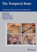 Sanna / Khrais / Falcioni |  The Temporal Bone | Buch |  Sack Fachmedien