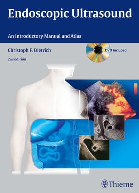 Dietrich |  Endoscopic Ultrasound | Buch |  Sack Fachmedien