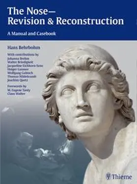 Behrbohm / Eichhorn-Sens / Quetz | The Nose - Revision and Reconstruction | Buch | 978-3-13-143591-0 | www.sack.de