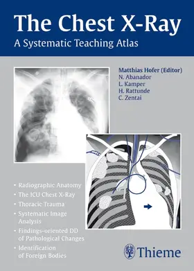 Hofer |  Chest X-ray Trainer | Buch |  Sack Fachmedien